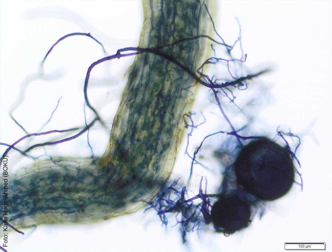 Mikroskopaufnahme einer blau gefärbten arbuskulären Mykorrhiza innerhalb und außerhalb einer Pflanzenwurzel 